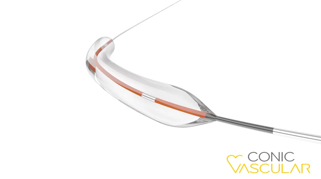 NC CLEVER PTCA Balloon Catheter-CONIC-1